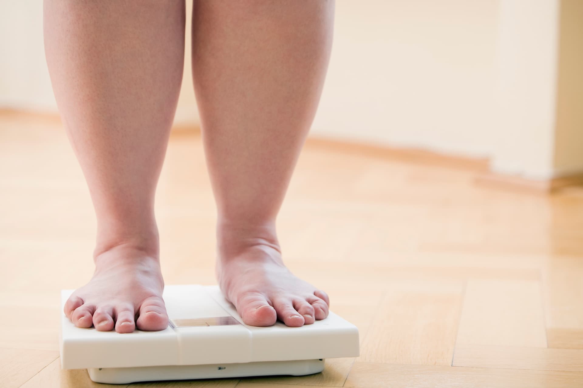 Forsa-Studie: Fast jeder zweite Deutsche fühlt sich zu dick