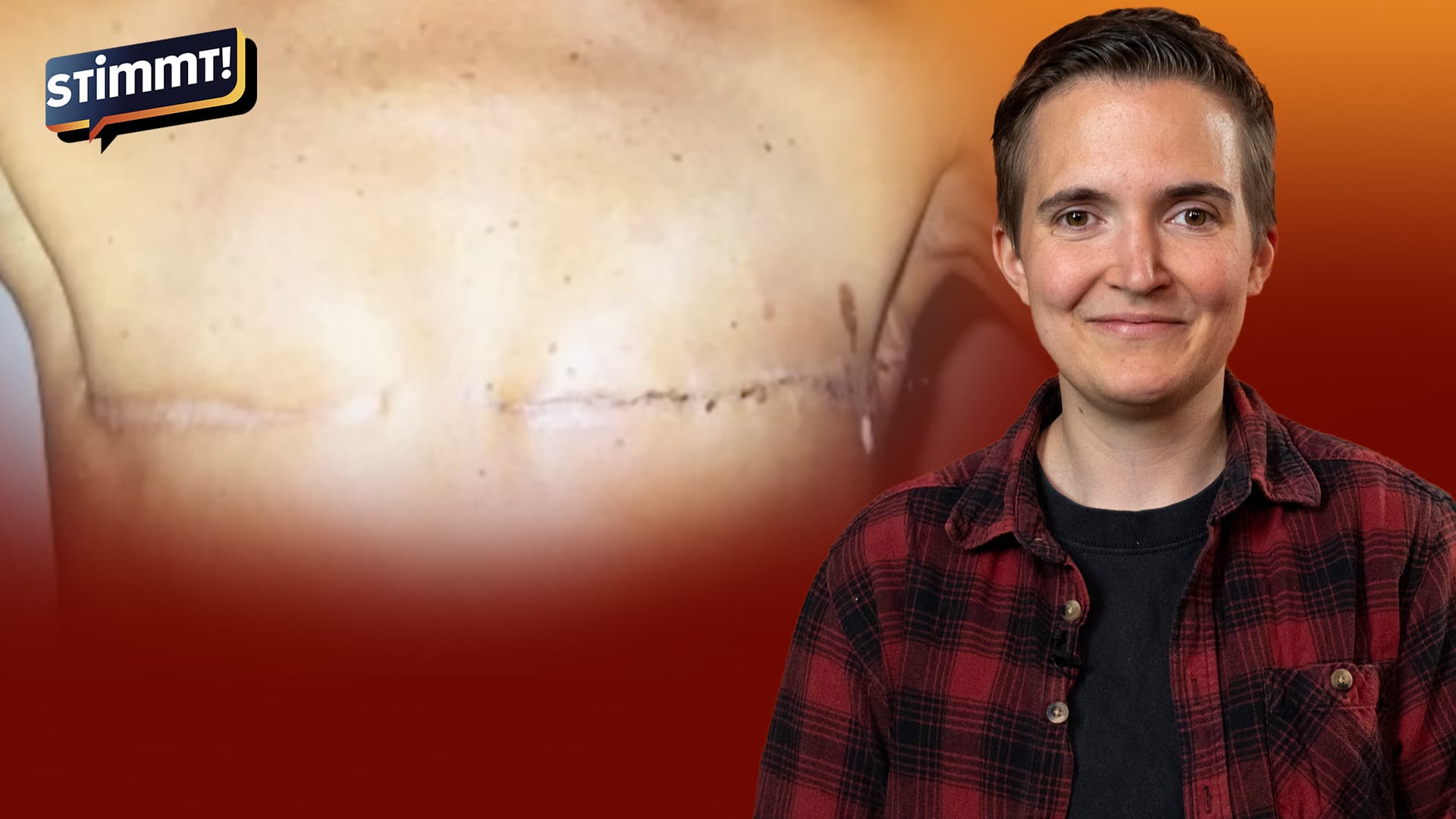 Von Frau zu Mann und zurück: „Habe diese OP sofort bereut!“