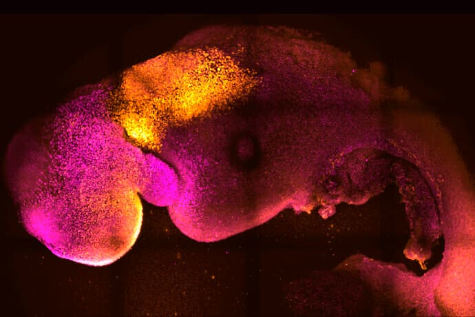 Umstrittene Sensation: Forscher erschaffen künstlichen menschlichen Embryo