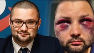AfD-Politiker zusammengeschlagen: „Dieses Schweigen war so dröhnend“