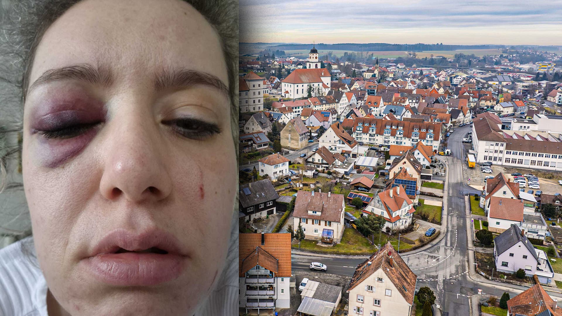 Weil sie ihn aufforderte, Essensreste wegzuwerfen: Unbegleiteter minderjähriger Flüchtling schlägt 37-Jährige krankenhausreif