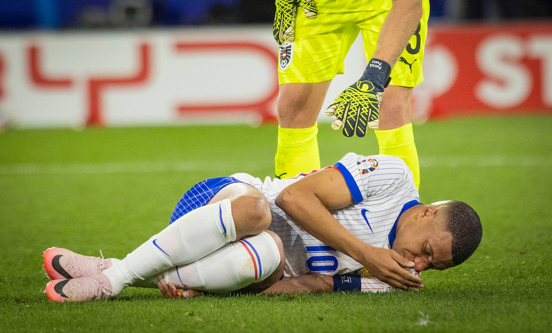 Nasenbeinbruch! Superstar Mbappé muss Zittersieg gegen Österreich teuer bezahlen
