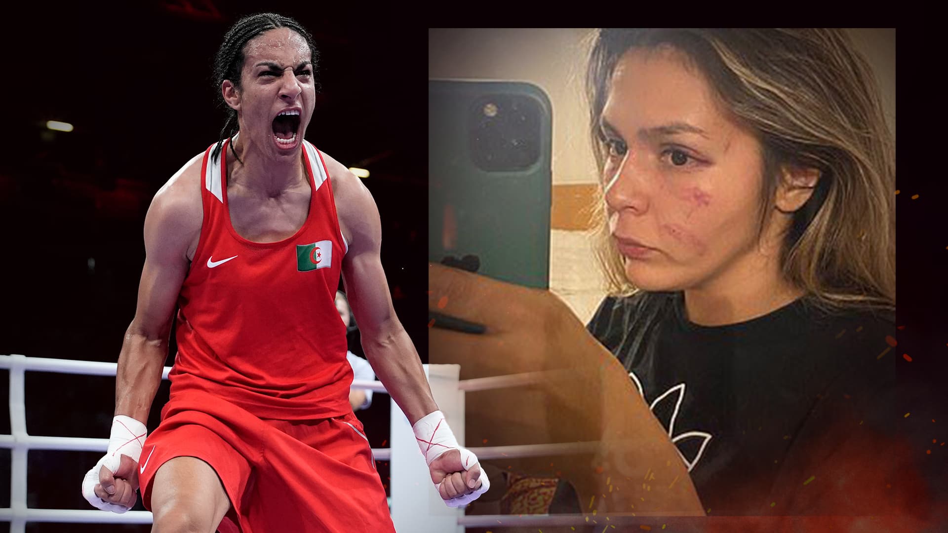 Heute Abend kämpft der Algerier um Gold: Boxerin, die von Imane Khelif verprügelt wurde, zeigt ihre Blessuren