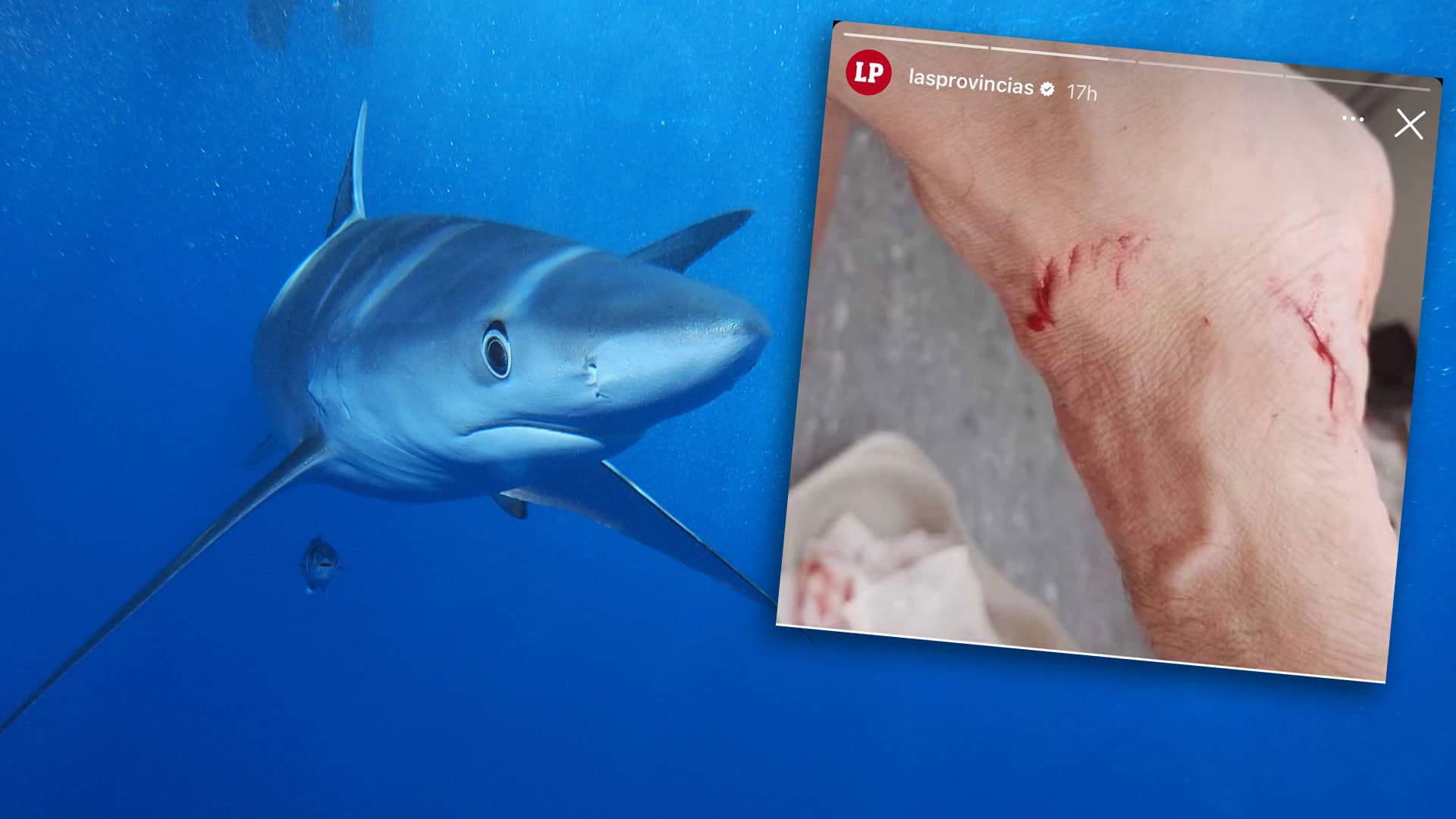 Hai-Attacke im Urlaubsparadies: Spanien machte Strände dicht